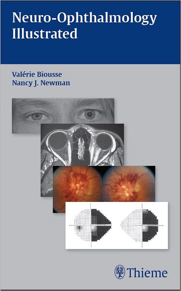 Neuro-Ophthalmology Illustrated