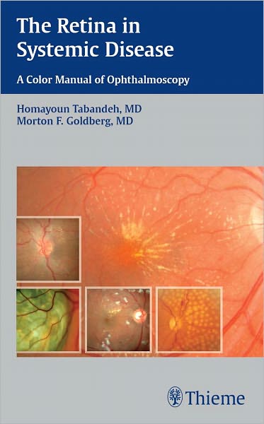 Retina in Systemic Disease: A Color Manual of Ophthalmoscopy