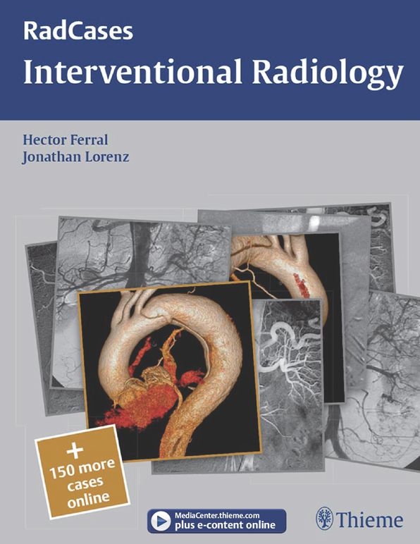 Interventional Radiology