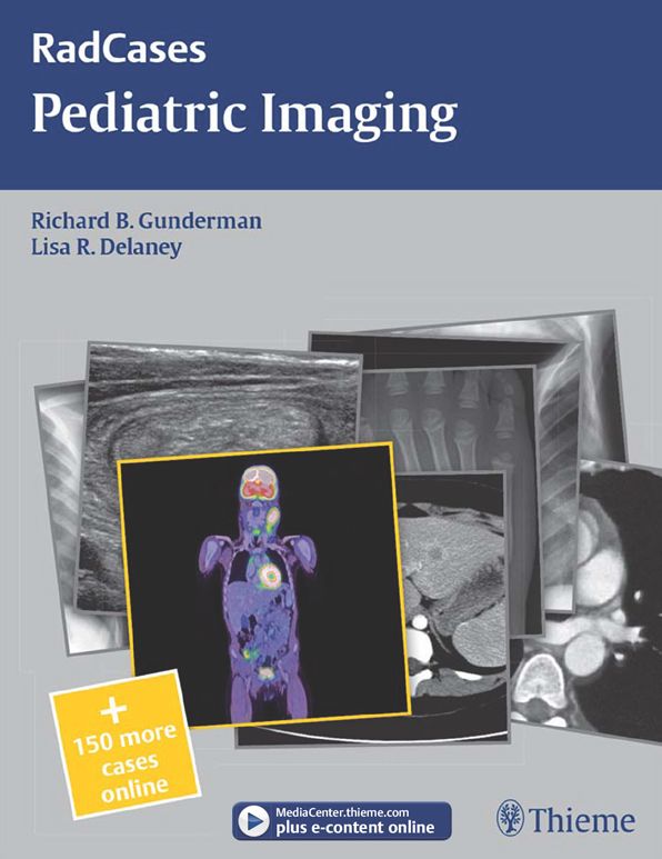 Pediatric Imaging