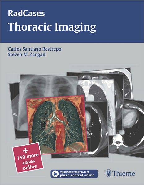 Thoracic Imaging