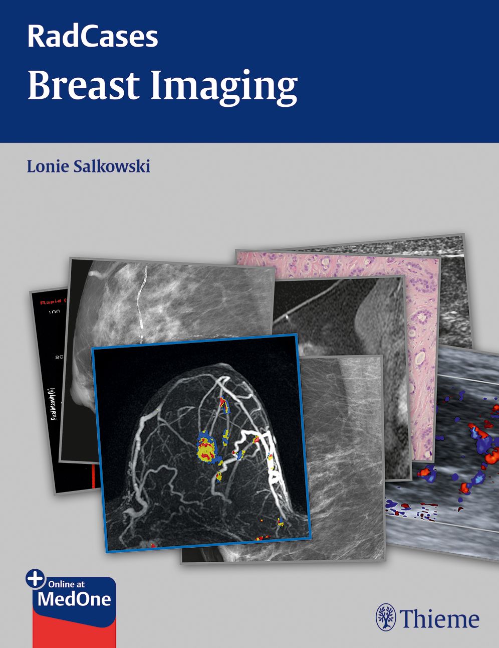 Breast Imaging