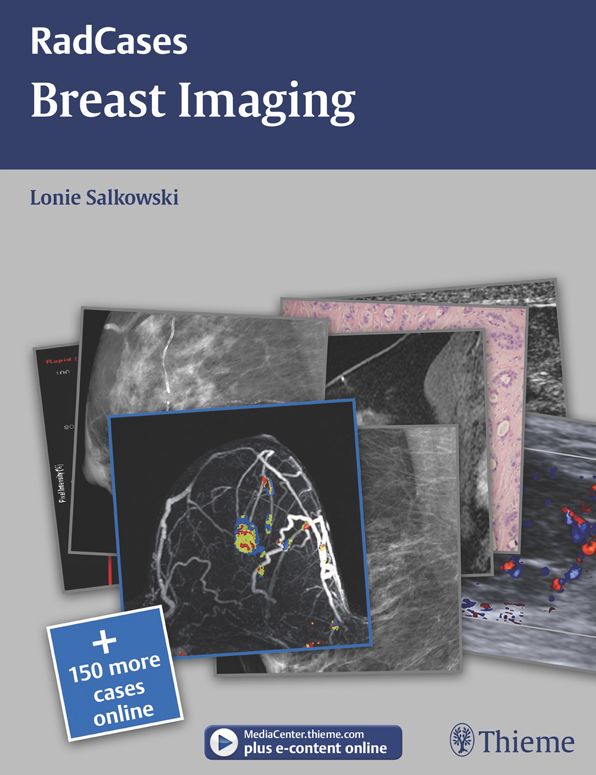 Breast Imaging