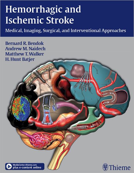 Hemorrhagic and Ischemic Stroke: Medical, Imaging, Surgical and Interventional Approaches
