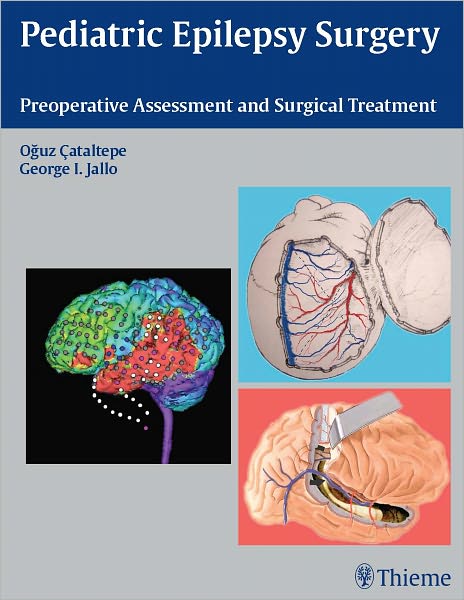 Pediatric Epilepsy Surgery: Preoperative Assessment and Surgical Treatment