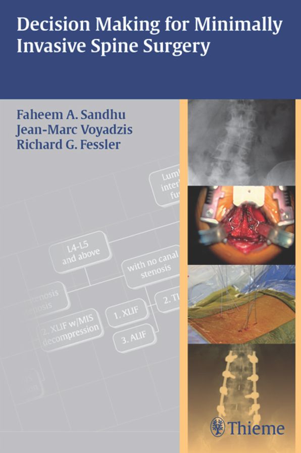 Decision Making for Minimally Invasive Spine Surgery
