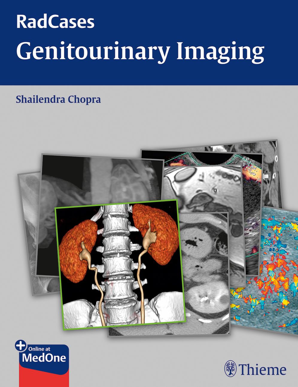 Genitourinary Imaging