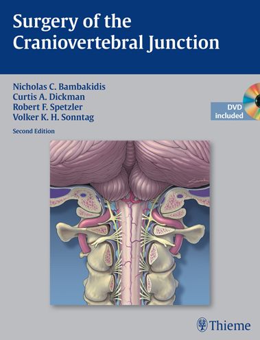Surgery of the Craniovertebral Junction