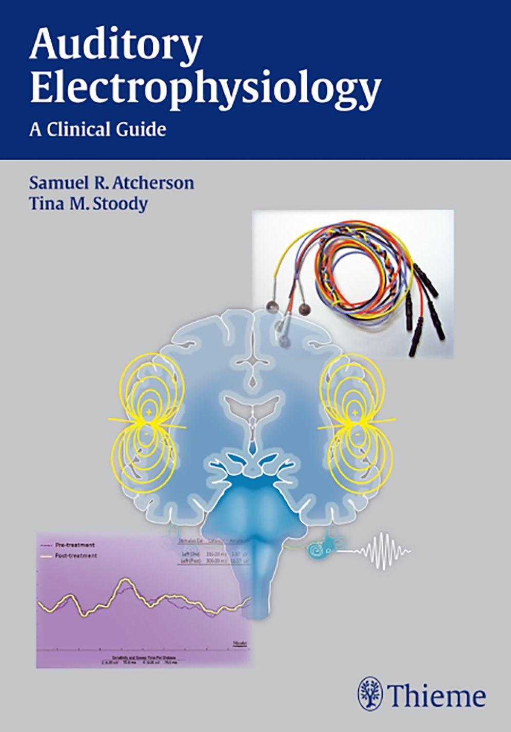 Auditory Electrophysiology: A Clinical Guide