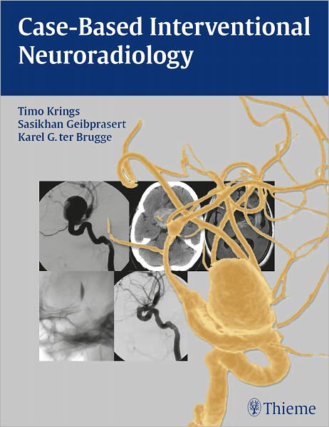Case-Based Interventional Neuroradiology
