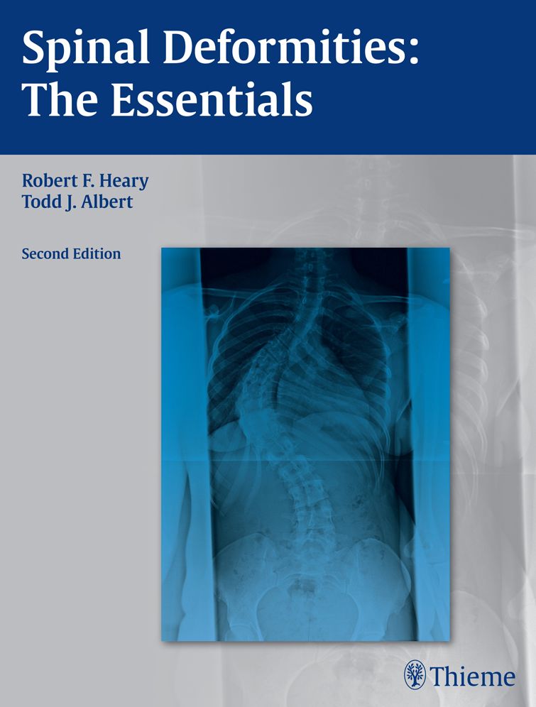Spinal Deformities: The Essentials