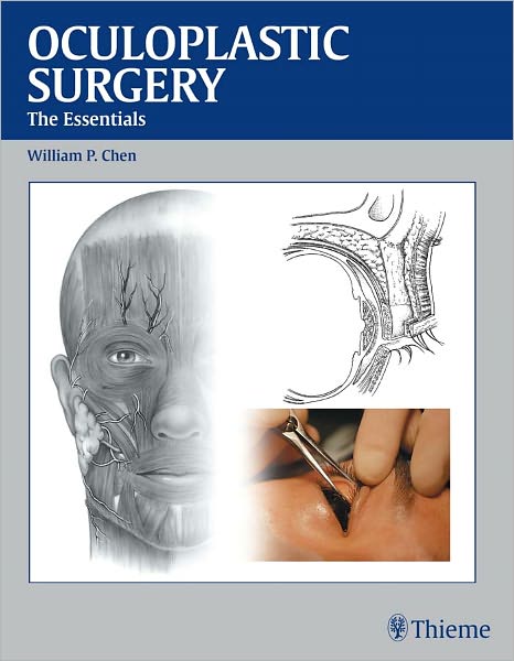 Oculoplastic Surgery: The Essentials