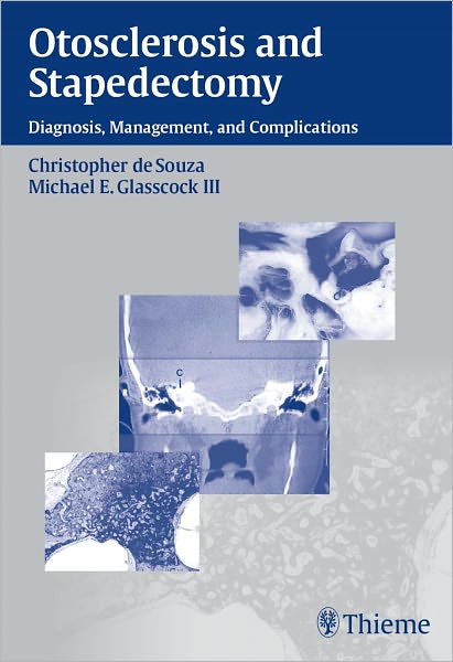 Otosclerosis and Stapedectomy: Diagnosis, Management & Complications