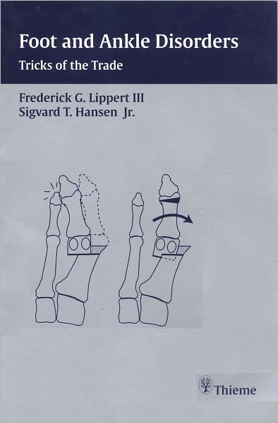 Foot and Ankle Disorders: Tricks of the Trade