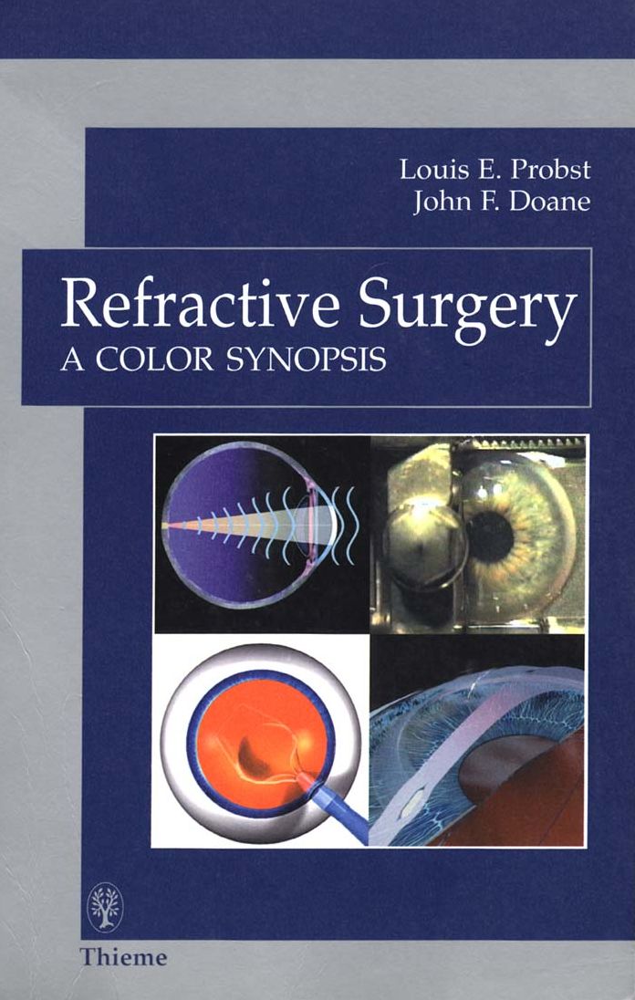 Refractive Surgery: A Color Synopsis: A Color Synopsis