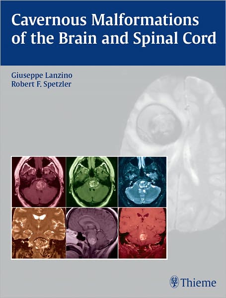 Cavernous Malformations of the Brain and Spinal Cord