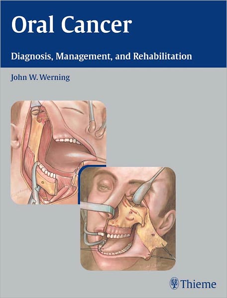 Oral Cancer: Diagnosis, Management, and Rehabilitation