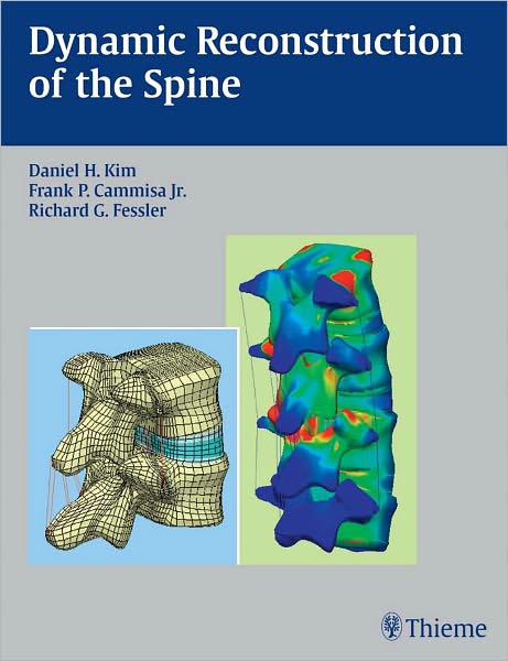Dynamic Reconstruction of the Spine