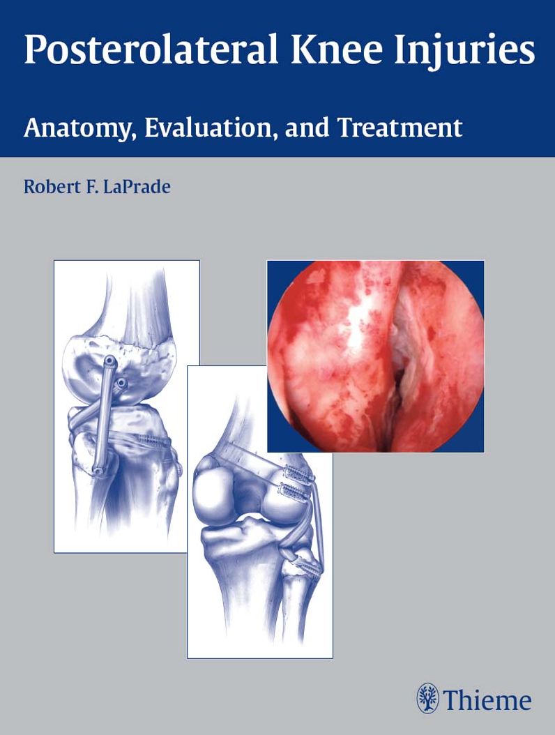 Posterolateral Knee Injuries: Anatomy, Evaluation, and Treatment