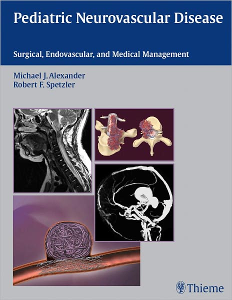 Pediatric Neurovascular Disease: Surgical, Endovascular and Medical Management