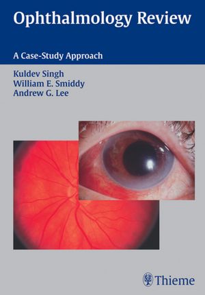 Ophthalmology Review: A Case Study Approach: A Case Study Approach