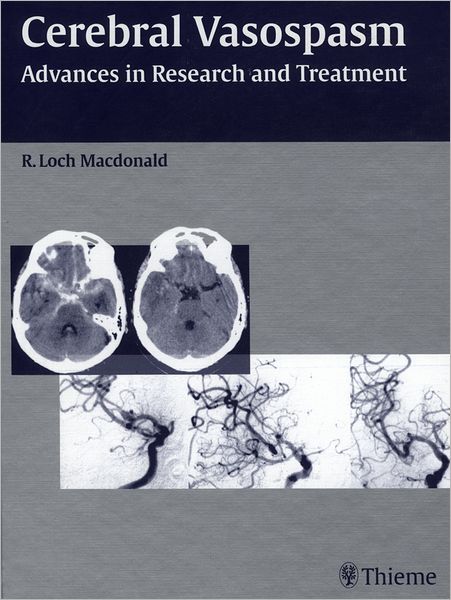 Cerebral Vasospasm: Advances in Research and Treatment