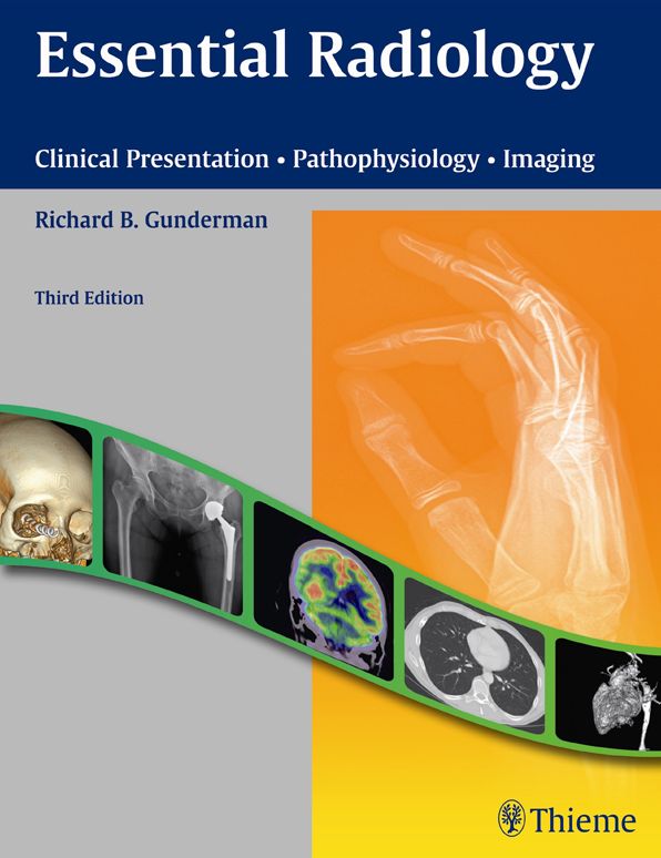 Essential Radiology: Clinical Presentation Pathophysiology Imaging