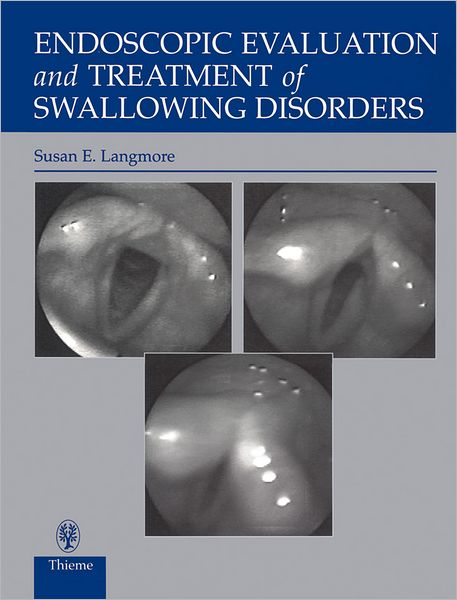 Endoscopic Evaluation and Treatment of Swallowing Disorders