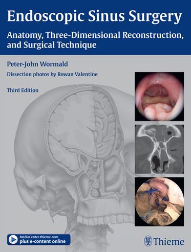 Endoscopic Sinus Surgery: Anatomy, Three-Dimensional Reconstruction, and Surgical Technique