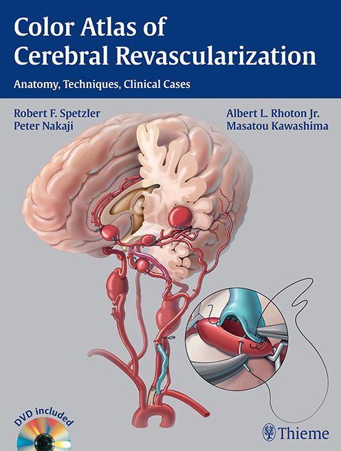 Color Atlas of Cerebral Revascularization: Anatomy, Techniques, Clinical Cases: Anatomy, Techniques, Clinical Cases