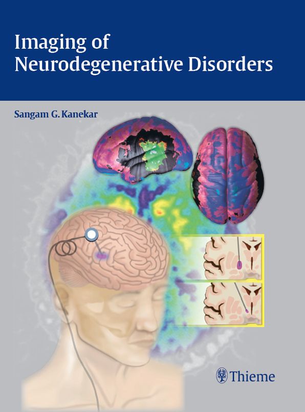 Imaging of Neurodegenerative Disorders