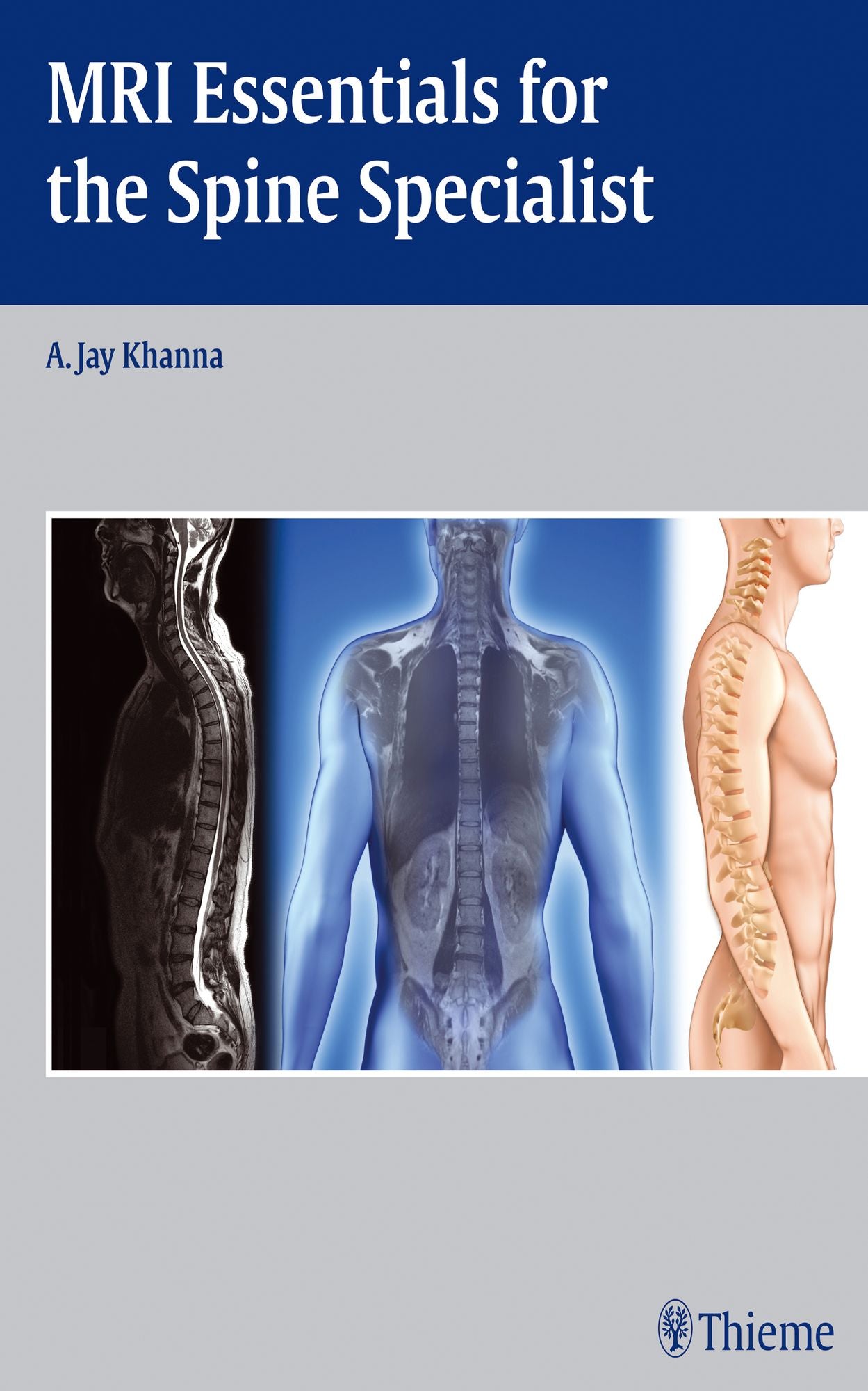 MRI Essentials for the Spine Specialist