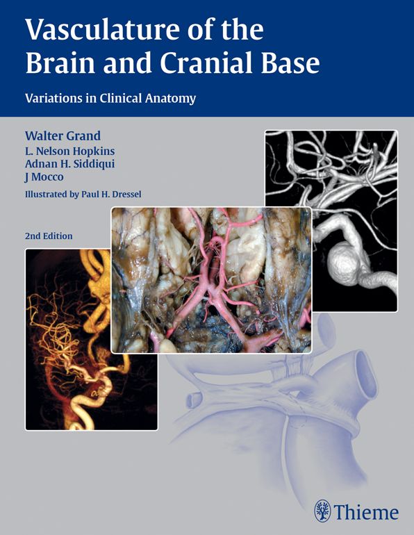 Vasculature of the Brain and Cranial Base