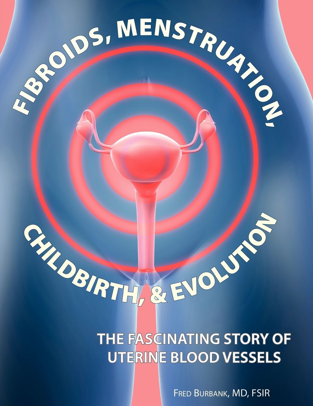 Fibroids, Menstruation, Childbirth, And Evolution