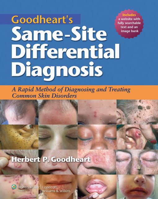 Goodheart's Same-Site Differential Diagnosis: A Rapid Method of Diagnosing and Treating Common Skin Disorders