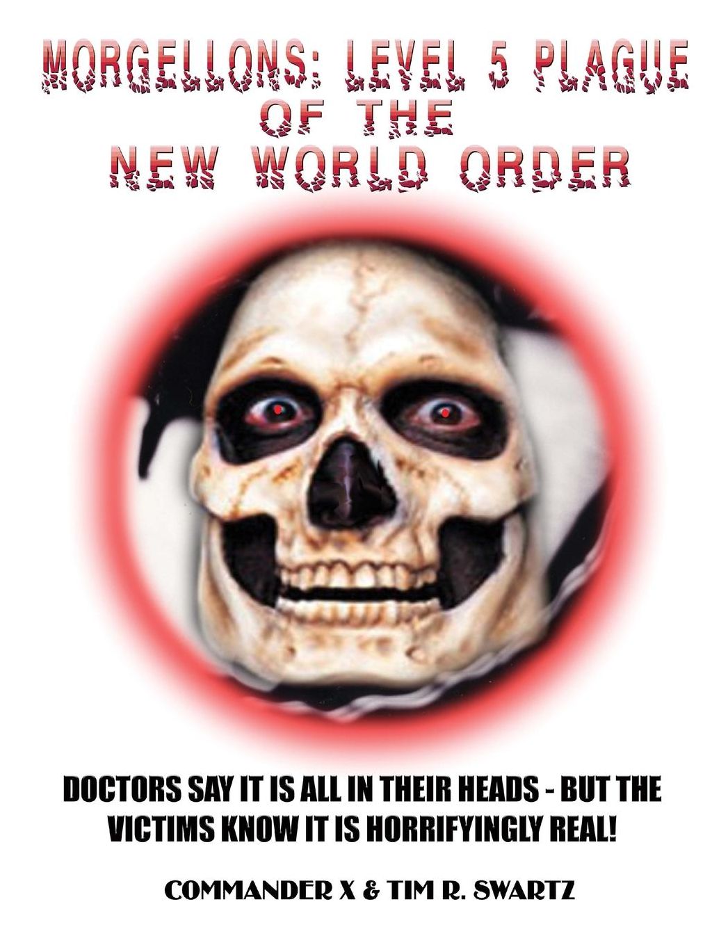 Morgellons: Level 5 Plague of the New World Order