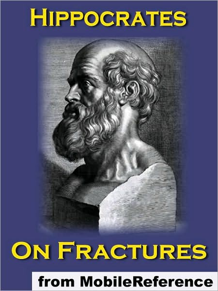 On Fractures