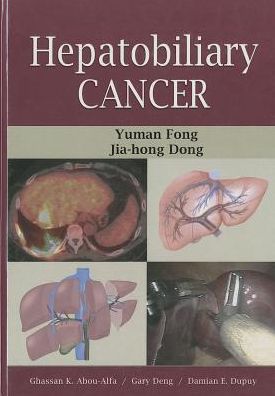 Hepatobiliary Cancer