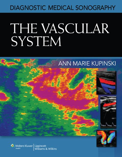 Diagnostic Medical Sonography (Diagnostic Medical Sonography Series): Vascular Imaging