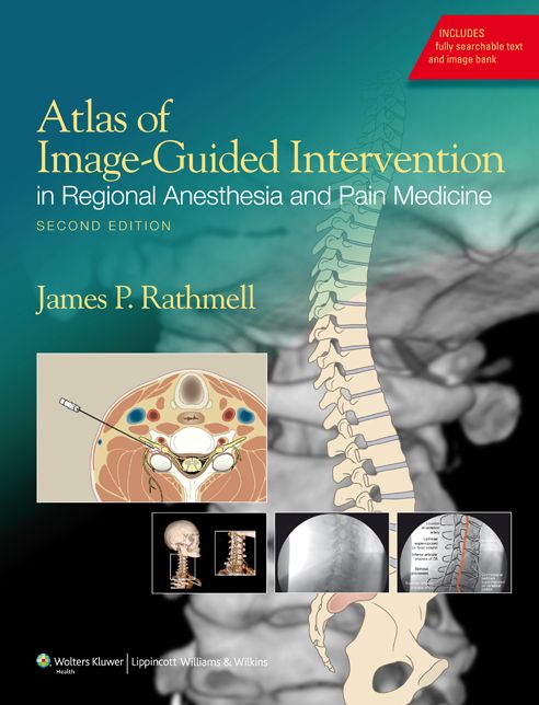 Atlas of Image-Guided Intervention in Pain Medicine