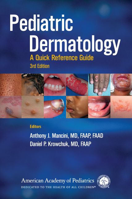 Pediatric Dermatology: A Quick Reference Guide