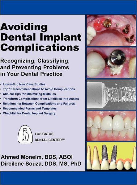 Avoiding Dental Implant Complications