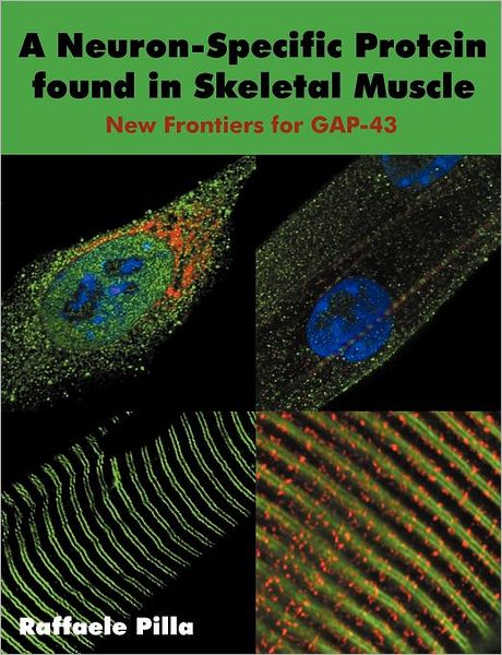 A Neuron-Specific Protein Found In Skeletal Muscle