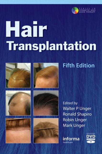Hair Transplantation