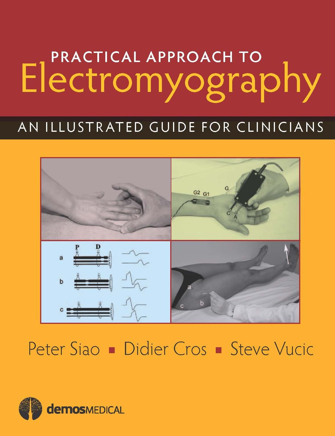 Practical Approach to Electromyography: An Illustrated Guide for Clinicians