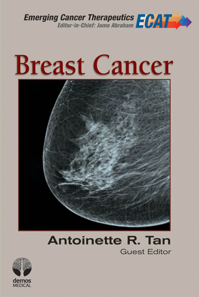Breast Cancer: ECT V1 I 3
