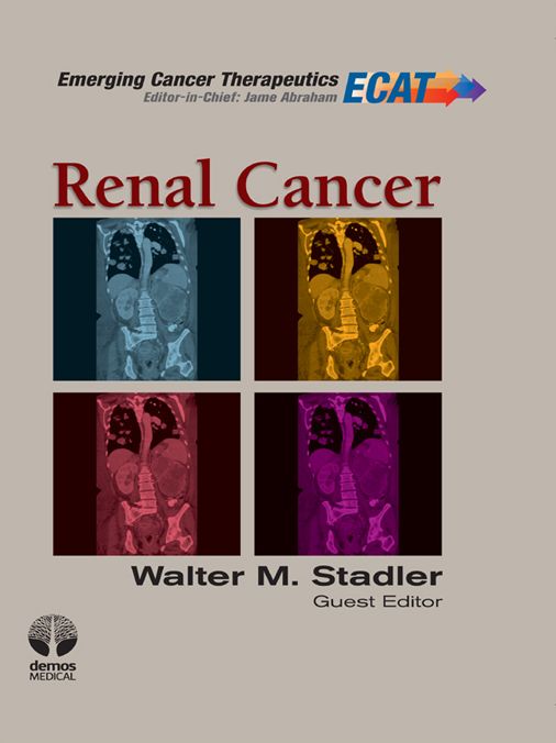 Renal Cancer: ECT