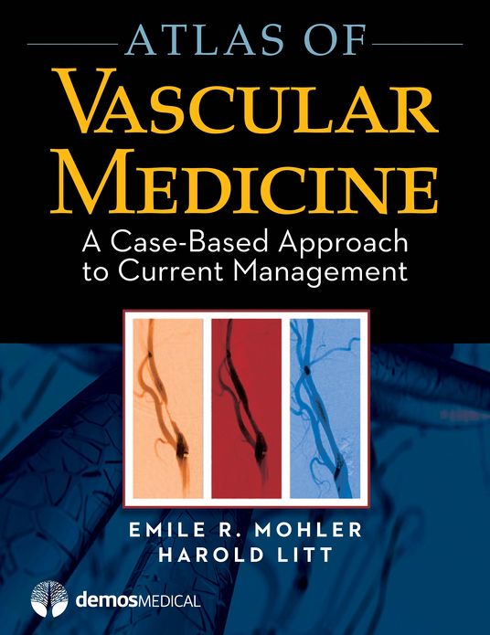 Atlas of Vascular Medicine: A Case-Based Approach to Current Management