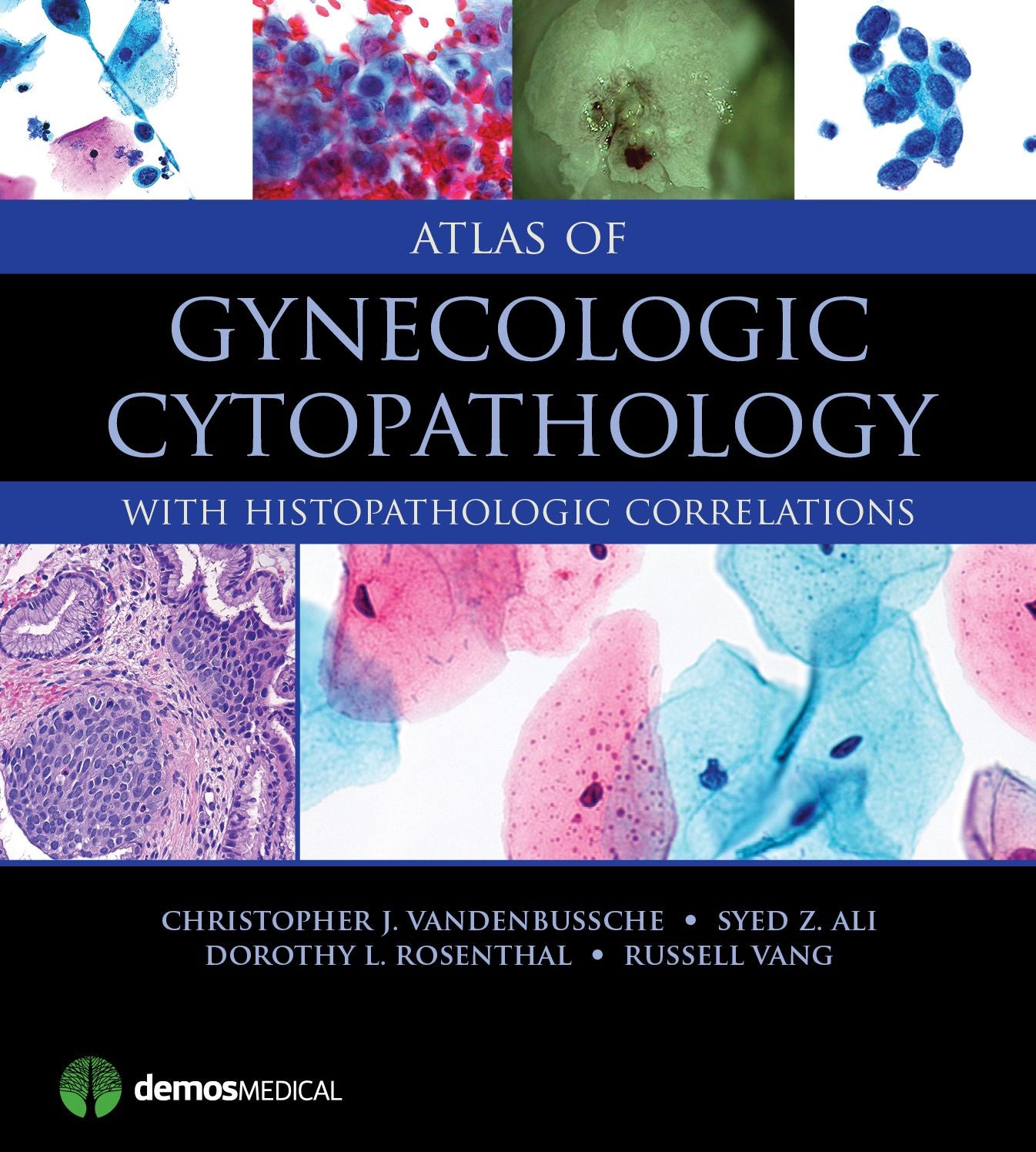 Atlas of Gynecologic Cytopathology: with Histopathologic Correlations