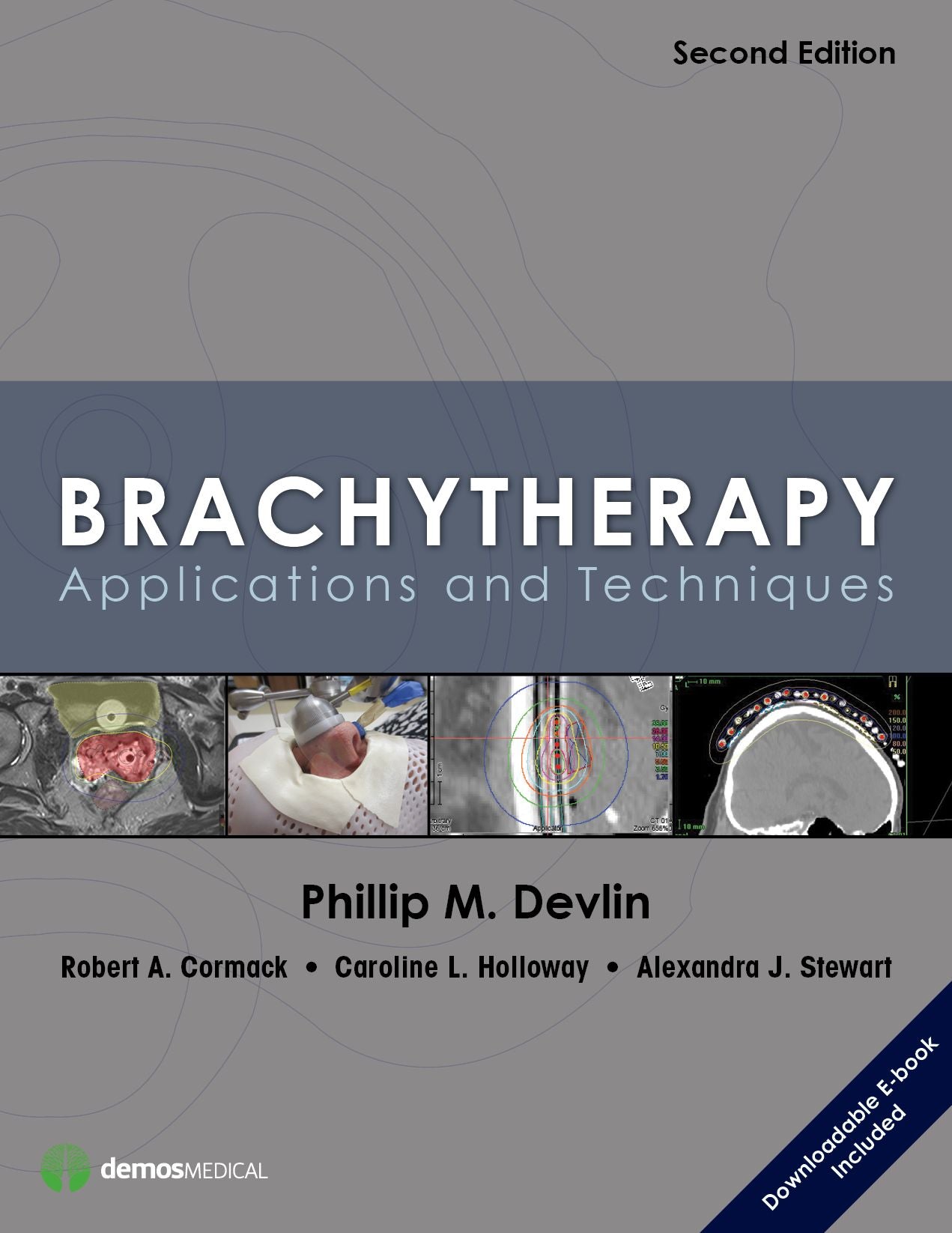 Brachytherapy: Applications and Techniques